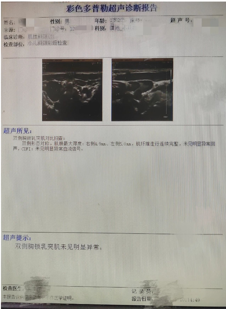 B超检查正常，为什么宝宝的头还是偏？