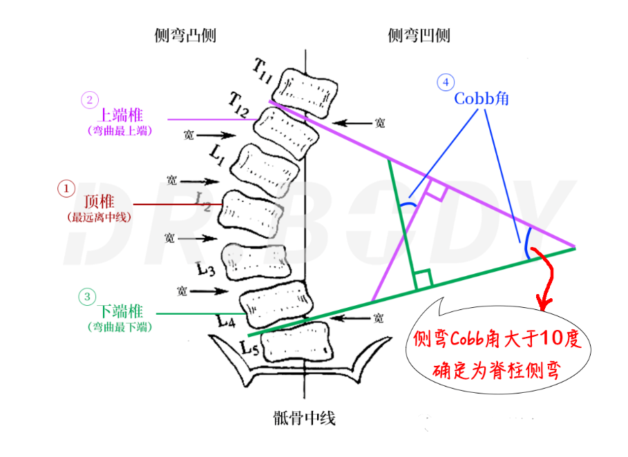 广东广州承启堂中医馆：别让脊柱侧弯拖孩子后腿！