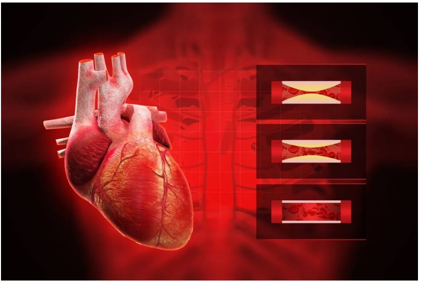 “致命杀手”冠心病，中医如何治疗呢？