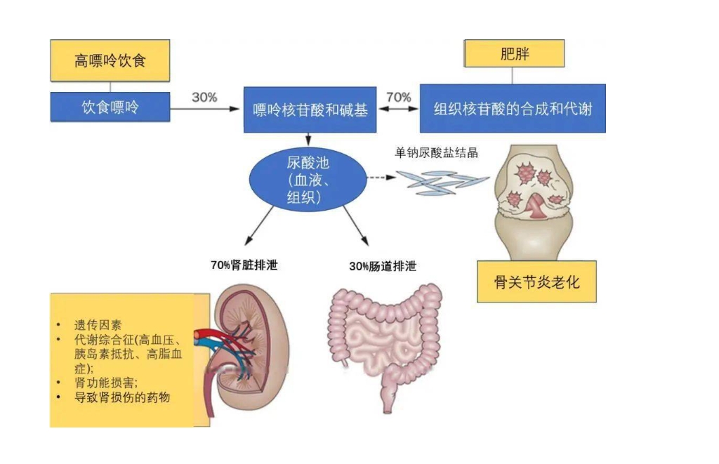 尿酸高，如何进行居家调理？