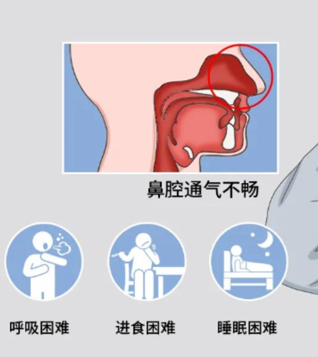 天冷了，宝宝鼻塞不通气？试试这几个小妙招！