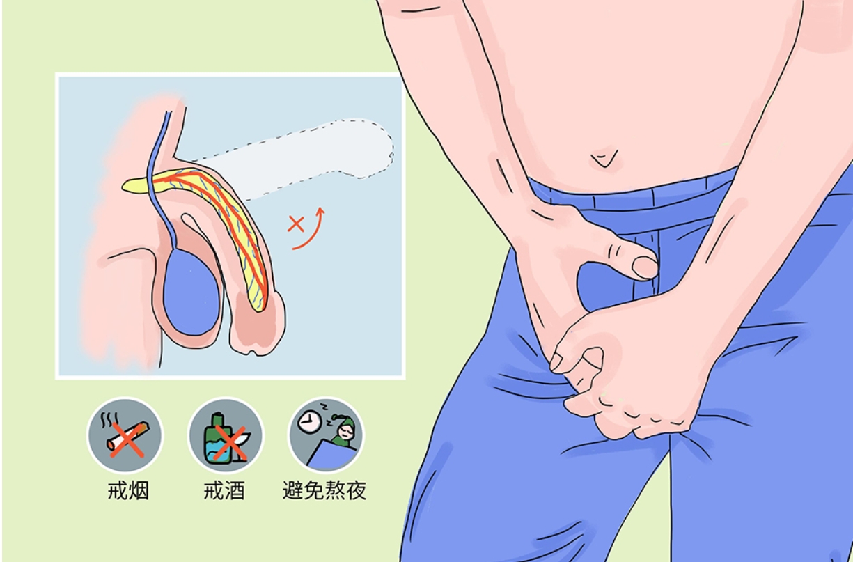 国医大师王琦治阳痿经验方总结