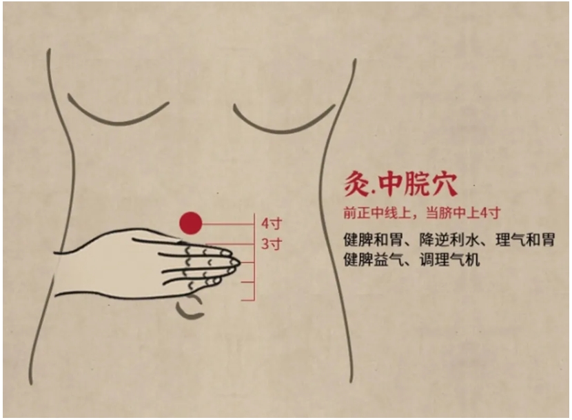 夏天冷饮进肚多胃寒，腹痛腹泻很常见，艾灸中脘散寒气