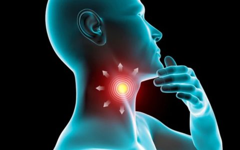 “许氏胃咽合剂”与慢性咽炎