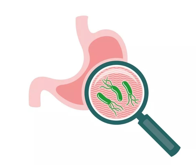 你想知道的幽门螺杆菌 这10问涵盖的很全面