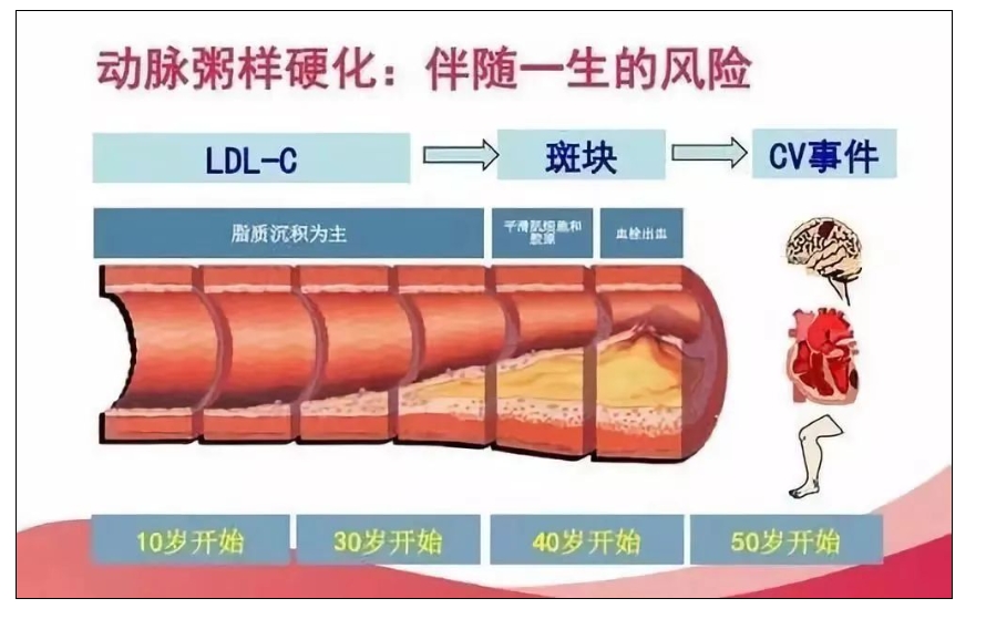 动脉硬化，有哪些危害？