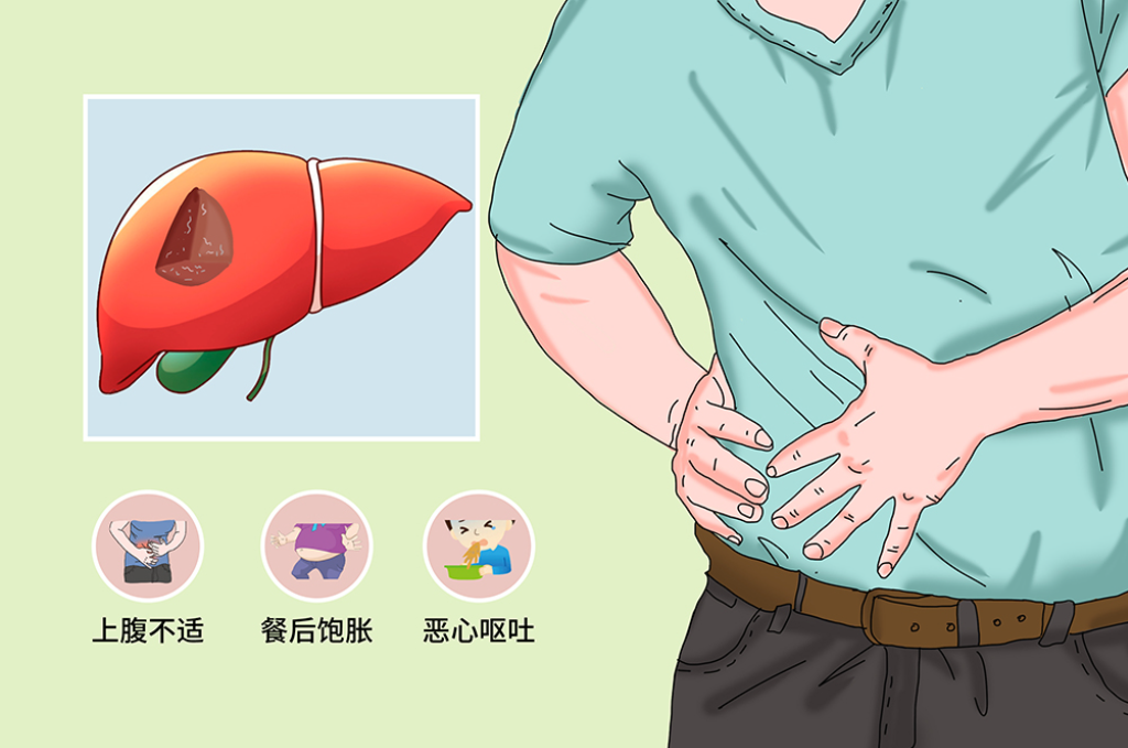肝囊肿并不可怕，分享2个简单方法
