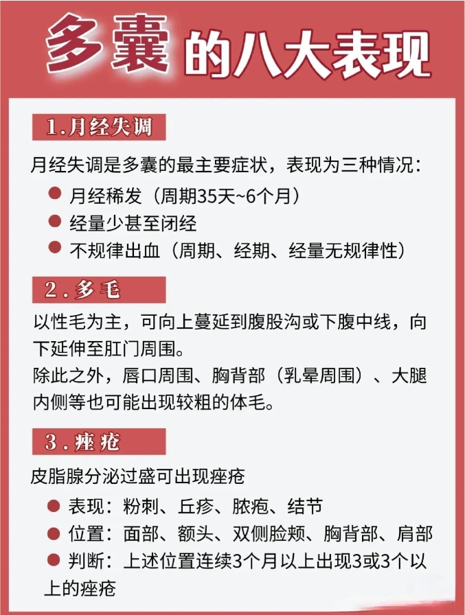 多囊的八大典型特征，你中了几条？