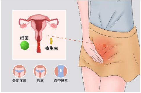 警惕|秋季女性3大妇科疾病高发，你重视了吗？