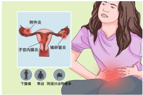 警惕|秋季女性3大妇科疾病高发，你重视了吗？